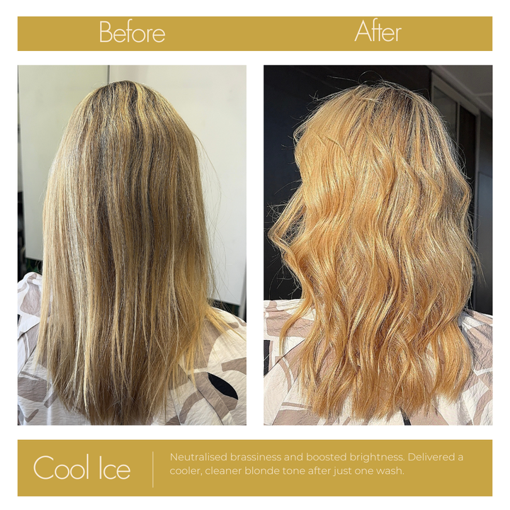 Deluxe Cool Ice Bundle